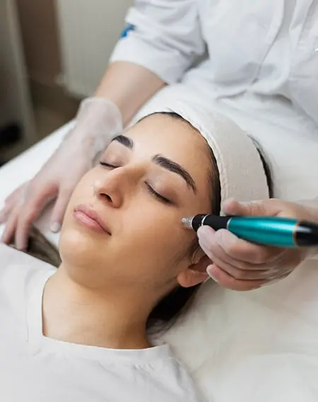 Skin Needling