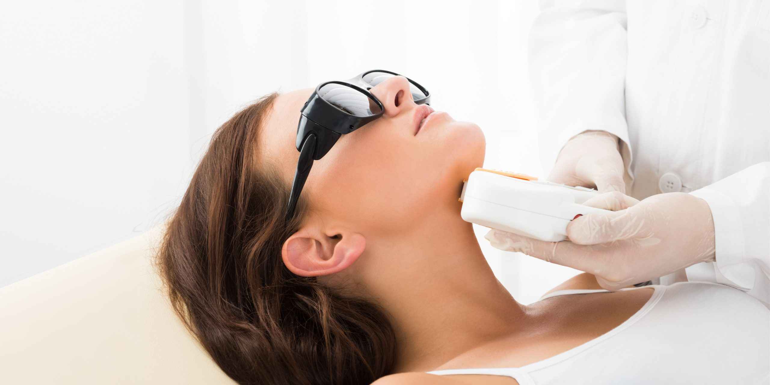 laser hair removal