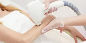 How Many Sessions of Laser Hair Removal Do You Need for Permanent Results