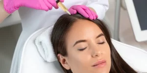 How Long Do PRP Hair Results Last